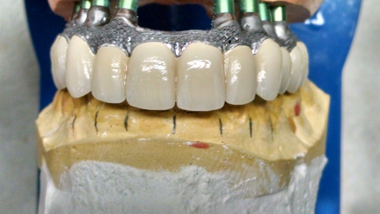 dental circular contour definition